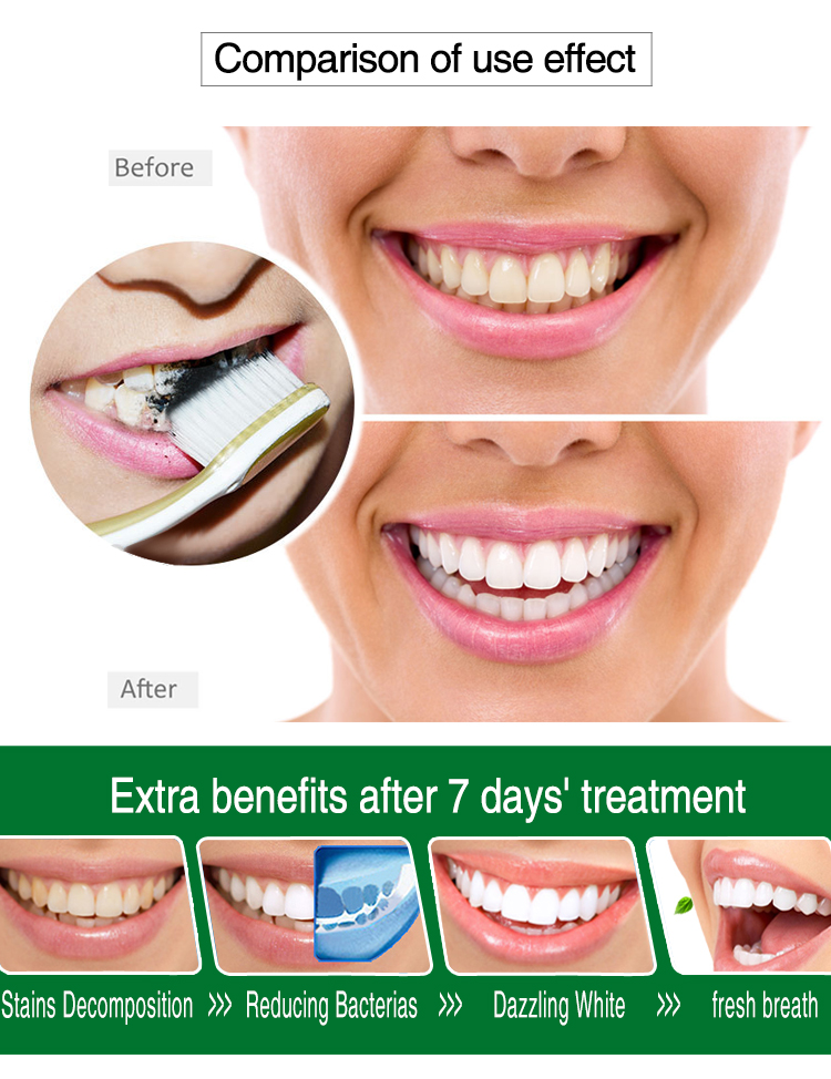 Activated Charcoal Teeth Whitening Powder