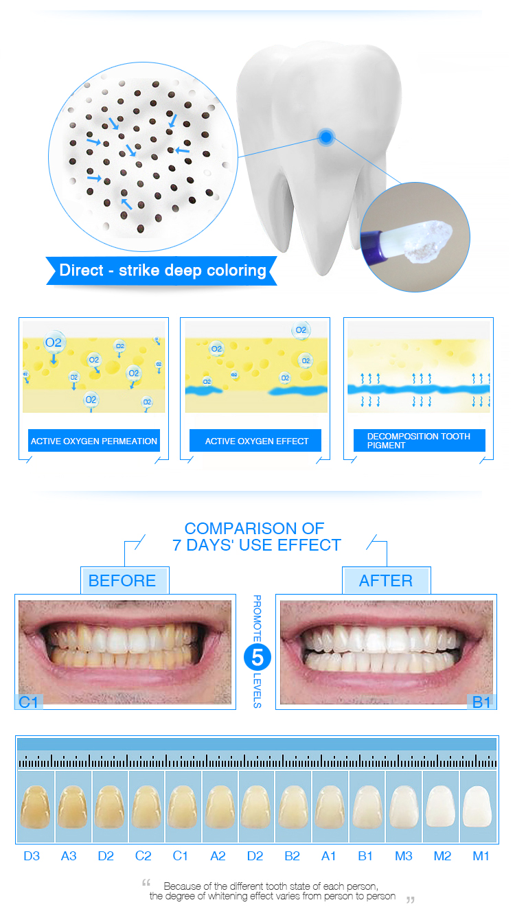 Mint Flavor Teeth Whitening Pen