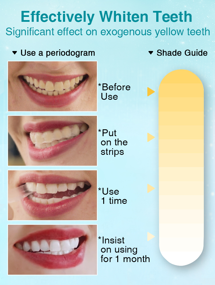 Changes after using whitening strips