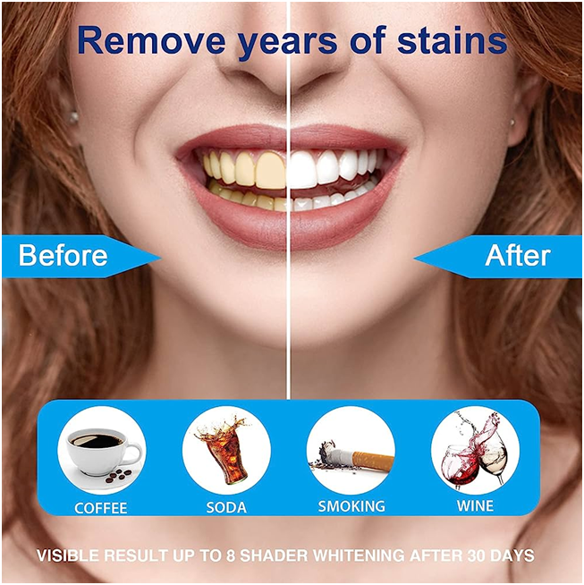 How Teeth Whitening Strips Work.png
