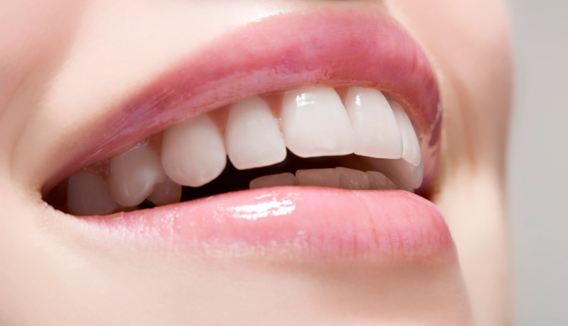 How to Use Teeth Whitening Gel Safely at Home? Complete Guide