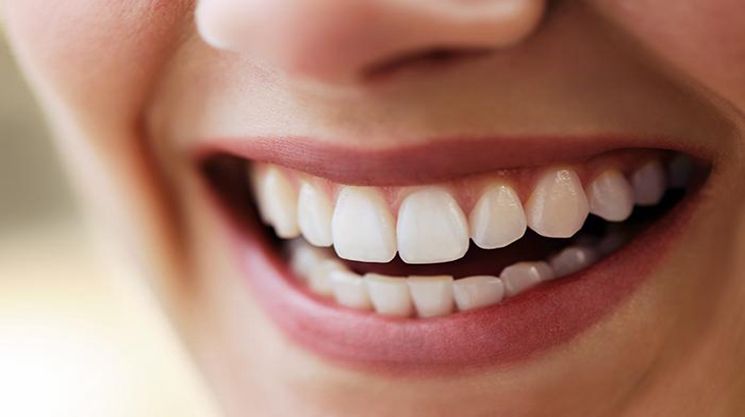 Non-Peroxide Teeth Whitening: Does It Work and Is It Safe?