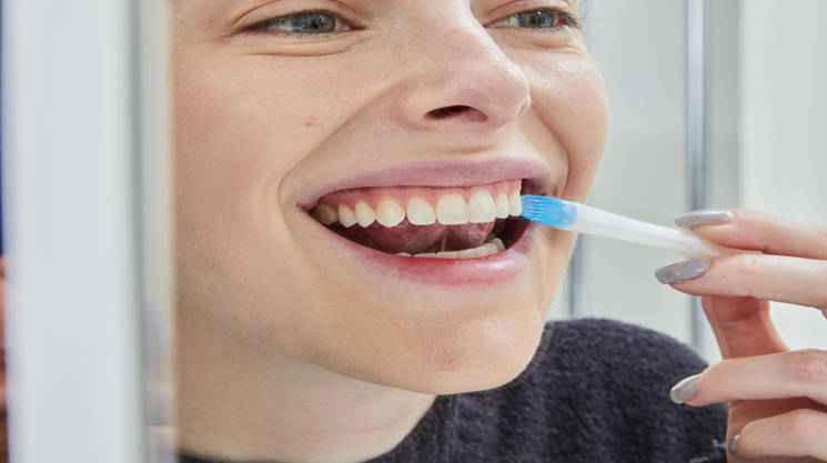 How to Use a Dental Whitening Kit