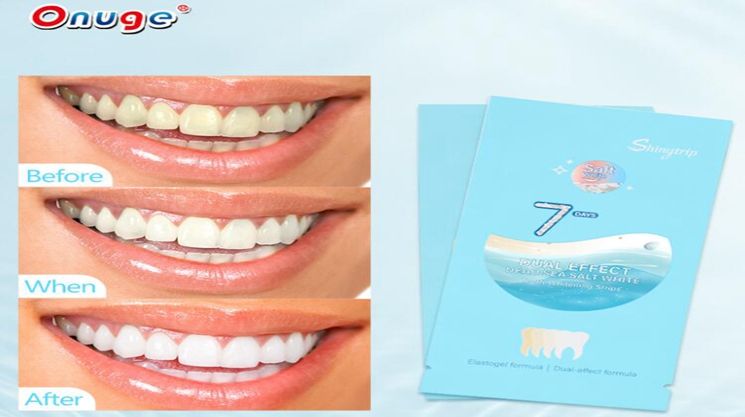 How Teeth Whitening Strips Work to Brighten Your Smile Naturally