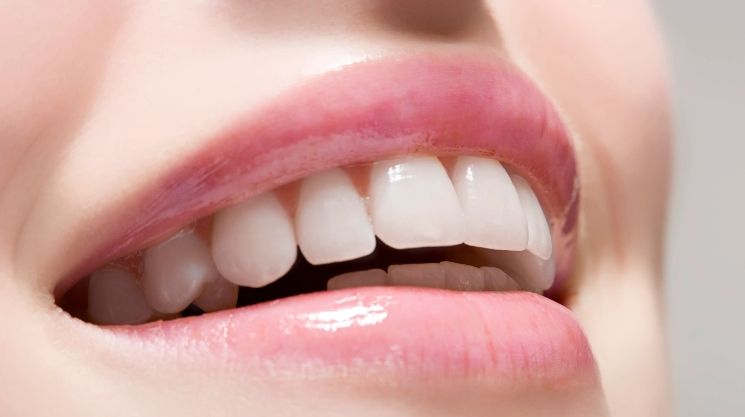 How to Use Teeth Whitening Gel Safely at Home? Complete Guide