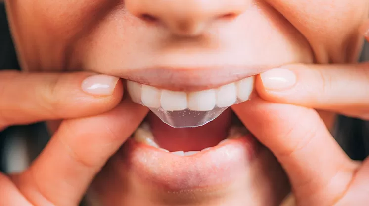 Whitening Strips vs Professional Whitening: Which Is Best For You?