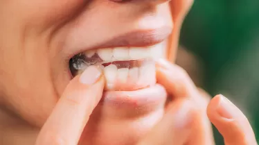 Non-Peroxide Whitening Safety: What Dentists Should Know Before Recommending