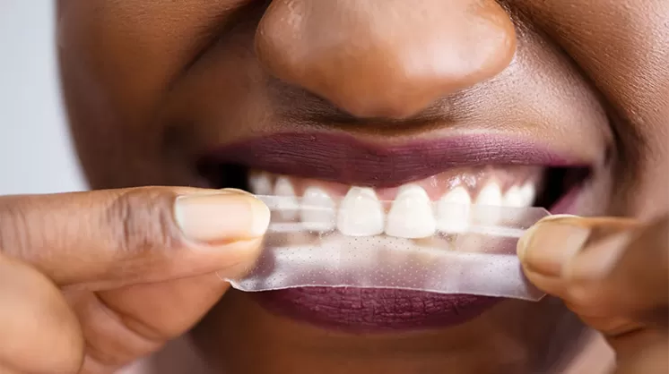 What Are Non-Peroxide Ingredients in Whitening Strips and How Do They Work?