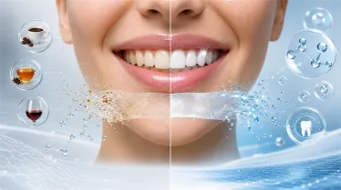Do Dissolving Whitening Strips Really Work?