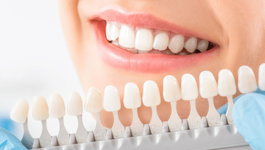 Are Peroxide-Free Or PAP Whitening Pens Effective