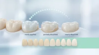How Long Do Dissolving Teeth Whitening Strips Take to Work?